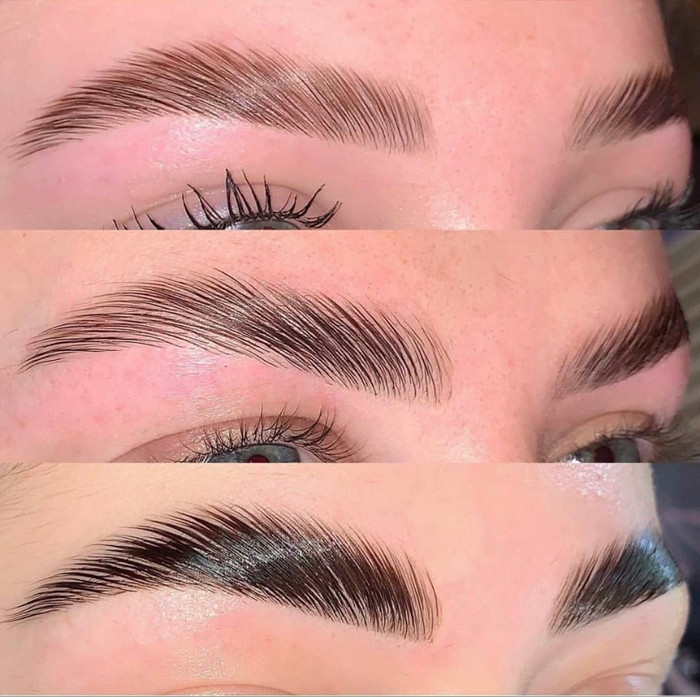 لیفت کامل ابرو