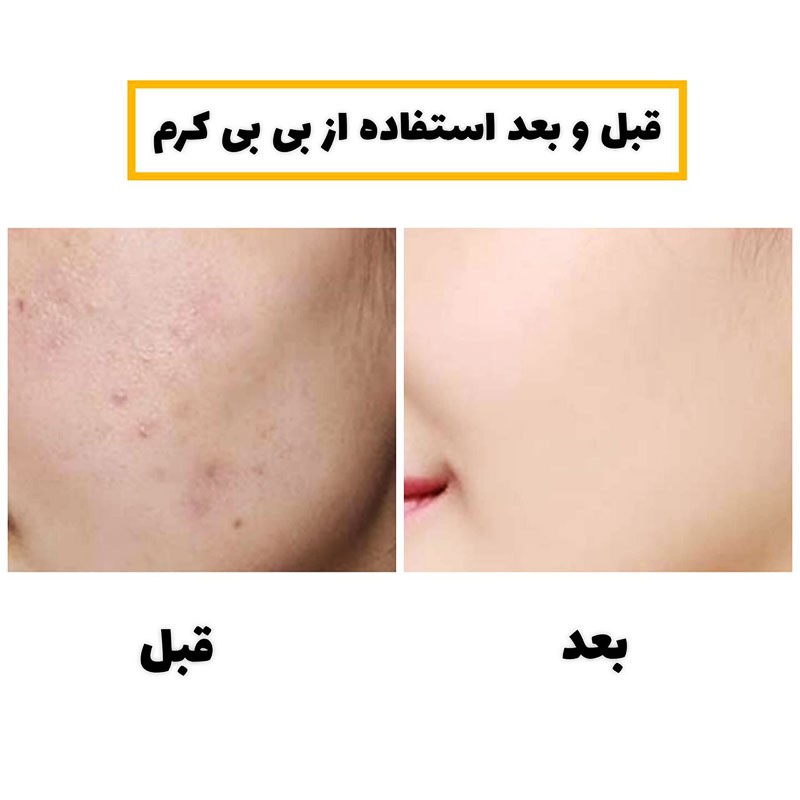 بسیار بافت سبک و بدون چربی